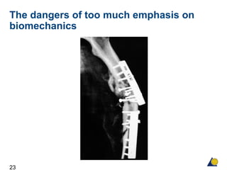 23
The dangers of too much emphasis on
biomechanics
 