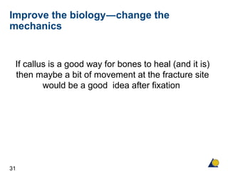 31
Improve the biology―change the
mechanics
If callus is a good way for bones to heal (and it is)
then maybe a bit of movement at the fracture site
would be a good idea after fixation
 