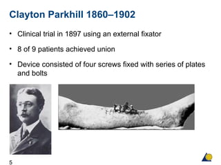 5
Clayton Parkhill 1860–1902
• Clinical trial in 1897 using an external fixator
• 8 of 9 patients achieved union
• Device consisted of four screws fixed with series of plates
and bolts
 