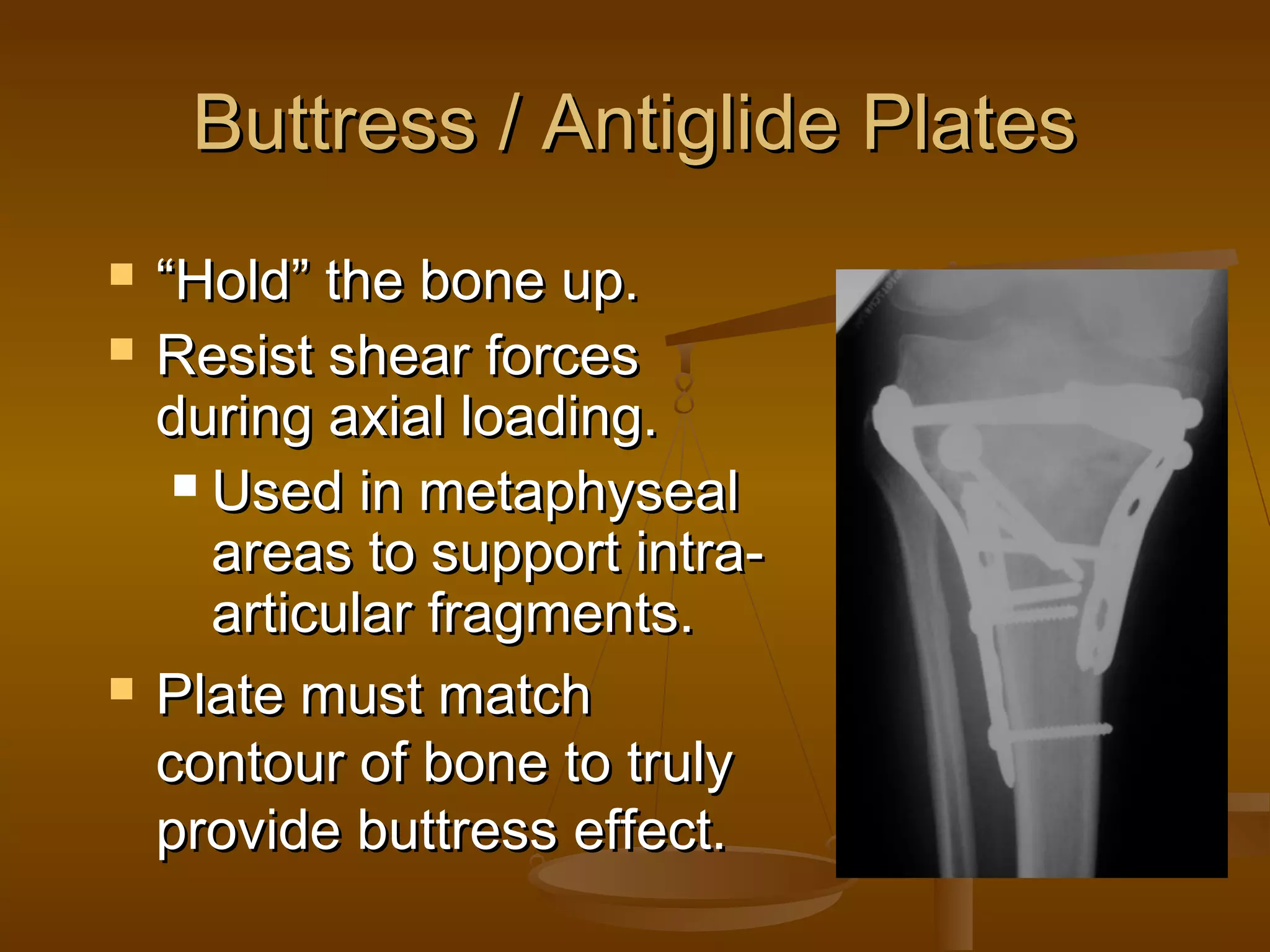 Buttress / Antiglide PlatesButtress / Antiglide Plates
 ““Hold” the bone up.Hold” the bone up.
 Resist shear forcesResist shear forces
during axial loading.during axial loading.
 Used in metaphysealUsed in metaphyseal
areas to support intra-areas to support intra-
articular fragments.articular fragments.
 Plate must matchPlate must match
contour of bone to trulycontour of bone to truly
provide buttress effect.provide buttress effect.
 