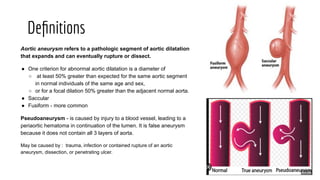 managementofAorticdiseases1111111111.pdf