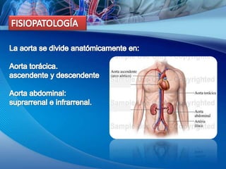 FISIOPATOLOGÍALa aorta se divide anatómicamente en: Aorta torácica.ascendente y descendenteAorta abdominal:suprarrenal e infrarrenal.