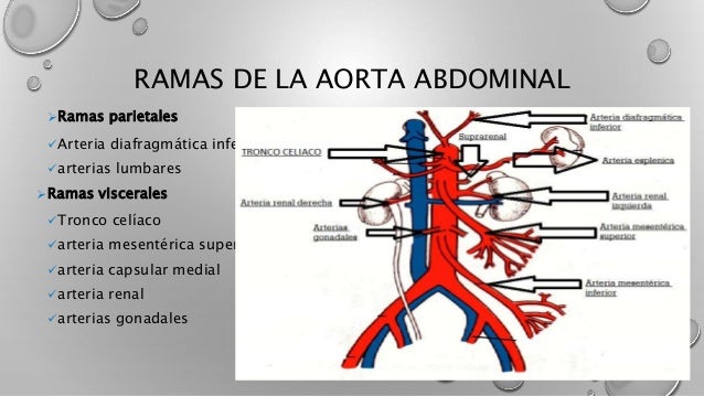 Aorta Abdominal y Arterias del Miembro Inferior