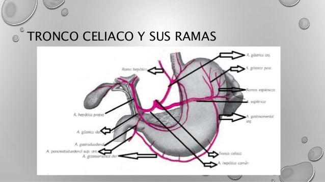 Tronco Celiaco Y Sus Ramas