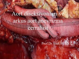 Aort diseksiyonları ve
arkus aort anevrizma
cerrahisi
Prof.Dr.Suat BUKET
 