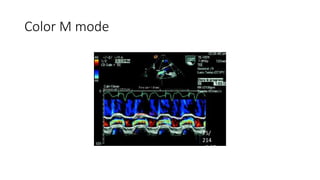 Color M mode
75/
214
=0.35
 