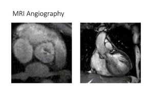MRI Angiography
 