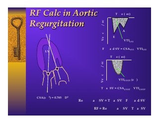 Time (sec)




                                     Velocity m/sec
                                                               A
                                                       E
                                                                VTILVI

                                           Forward SV = CSALVI x VTILVI
     LV
                                                      Time (sec)




                                    Velocity m/sec
                                                             VTILVOT (cm)

                                       Total SV = CSALVOT x VTILVOT


CSA(cm2) = 0.785 x D2
                        Regurgitant SV = Total SV – Forward SV

                                RF = Regurgitant SV – Total SV
 