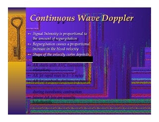 Aortic  Regurgitation