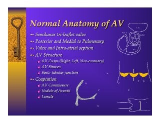 LA
                                    NCC
                                                         LCC


                                            RCC

                                               RV




                                            Plane of
                                   Sinus of Side View
                                   Valsalva
                        Annulus

                                                    Free Edge
       Aorta                      Commissure

                 Coaptation               Frontal View
     Leaflet     Surface


                 Nodule of                               Sino-
                 Arantus                                 Tubular
LV   Side View                                           Junction
 