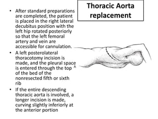 • After standard preparations
are completed, the patient
is placed in the right lateral
decubitus position with the
left hip rotated posteriorly
so that the left femoral
artery and vein are
accessible for cannulation.
• A left posterolateral
thoracotomy incision is
made, and the pleural space
is entered through the top
of the bed of the
nonresected fifth or sixth
rib
• If the entire descending
thoracic aorta is involved, a
longer incision is made,
curving slightly inferiorly at
the anterior portion
Thoracic Aorta
replacement
 
