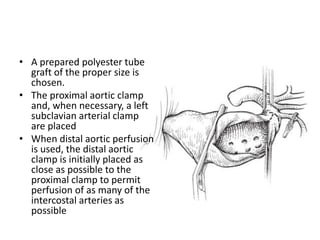 • A prepared polyester tube
graft of the proper size is
chosen.
• The proximal aortic clamp
and, when necessary, a left
subclavian arterial clamp
are placed
• When distal aortic perfusion
is used, the distal aortic
clamp is initially placed as
close as possible to the
proximal clamp to permit
perfusion of as many of the
intercostal arteries as
possible
 