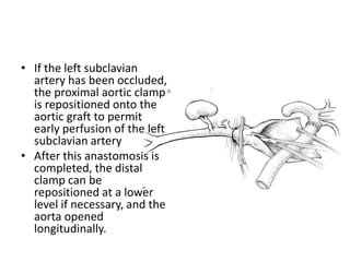 • If the left subclavian
artery has been occluded,
the proximal aortic clamp
is repositioned onto the
aortic graft to permit
early perfusion of the left
subclavian artery
• After this anastomosis is
completed, the distal
clamp can be
repositioned at a lower
level if necessary, and the
aorta opened
longitudinally.
 