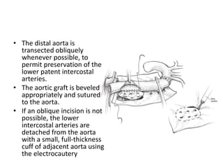 • The distal aorta is
transected obliquely
whenever possible, to
permit preservation of the
lower patent intercostal
arteries.
• The aortic graft is beveled
appropriately and sutured
to the aorta.
• If an oblique incision is not
possible, the lower
intercostal arteries are
detached from the aorta
with a small, full-thickness
cuff of adjacent aorta using
the electrocautery
 