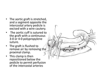 • The aortic graft is stretched,
and a segment opposite the
intercostal artery pedicle is
excised with a wire cautery.
• The aortic cuff is sutured to
the graft with a continuous
3-0 or 4-0 polypropylene
suture.
• The graft is flushed to
remove air by removing the
proximal clamp.
• This clamp is then
repositioned below the
pedicle to permit perfusion
of the intercostal arteries
 