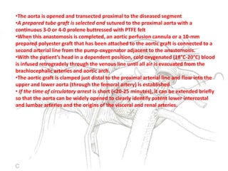 •The aorta is opened and transected proximal to the diseased segment
•A prepared tube graft is selected and sutured to the proximal aorta with a
continuous 3-0 or 4-0 prolene buttressed with PTFE felt
•When this anastomosis is completed, an aortic perfusion cannula or a 10-mm
prepared polyester graft that has been attached to the aortic graft is connected to a
second arterial line from the pump-oxygenator adjacent to the anastomosis.
•With the patient’s head in a dependent position, cold oxygenated (18°C-20°C) blood
is infused retrogradely through the venous line until all air is evacuated from the
brachiocephalic arteries and aortic arch.
•The aortic graft is clamped just distal to the proximal arterial line and flow into the
upper and lower aorta (through the femoral artery) is established
• If the time of circulatory arrest is short (<20-25 minutes), it can be extended briefly
so that the aorta can be widely opened to clearly identify patent lower intercostal
and lumbar arteries and the origins of the visceral and renal arteries.
 