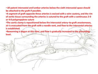 • All patent intercostal and lumbar arteries below the sixth intercostal space should
be attached to the graft if possible.
•A segment of graft opposite these arteries is excised with a wire cautery, and the rim
of aortic tissue surrounding the arteries is sutured to the graft with a continuous 3-0
or 4-0 polypropylene suture
•The aortic clamp is repositioned below the intercostal artery–to-graft anastomoses,
air is evacuated from the graft with a needle vent, and flow to the intercostal arteries
is established.
•Rewarming is begun at this time, and flow is gradually increased to the precooling
level.
 