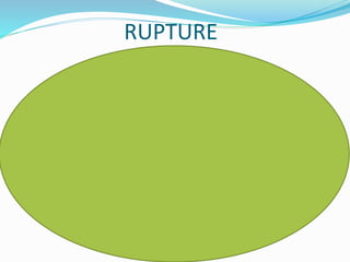 RUPTURE
 