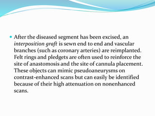  After the diseased segment has been excised, an
interposition graft is sewn end to end and vascular
branches (such as coronary arteries) are reimplanted.
Felt rings and pledgets are often used to reinforce the
site of anastomosis and the site of cannula placement.
These objects can mimic pseudoaneurysms on
contrast-enhanced scans but can easily be identified
because of their high attenuation on nonenhanced
scans.
 