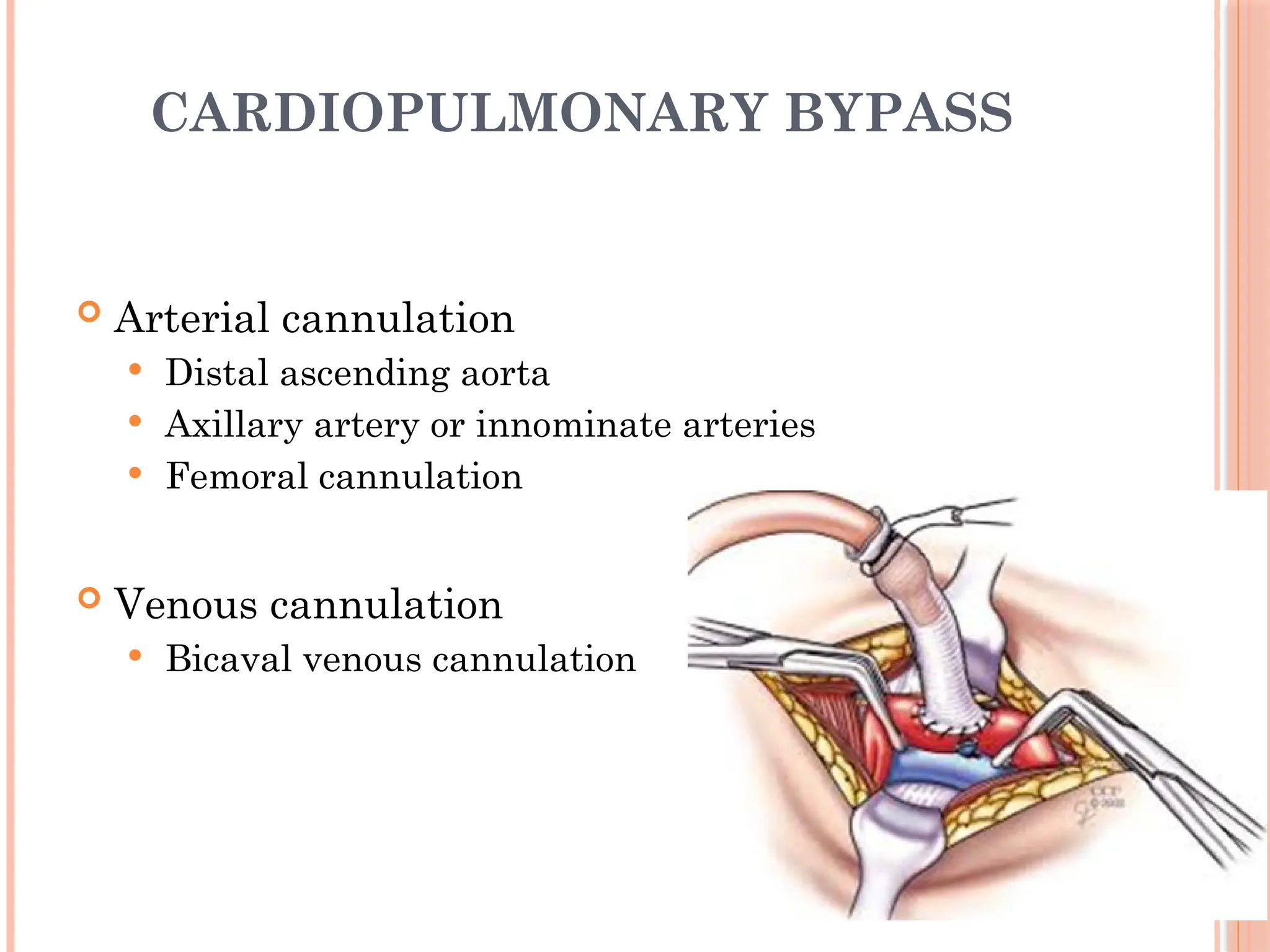 CARDIOPULMONARY BYPASS
 Arterial cannulation
 Distal ascending aorta
 Axillary artery or innominate arteries
 Femoral cannulation
 Venous cannulation
 Bicaval venous cannulation
 