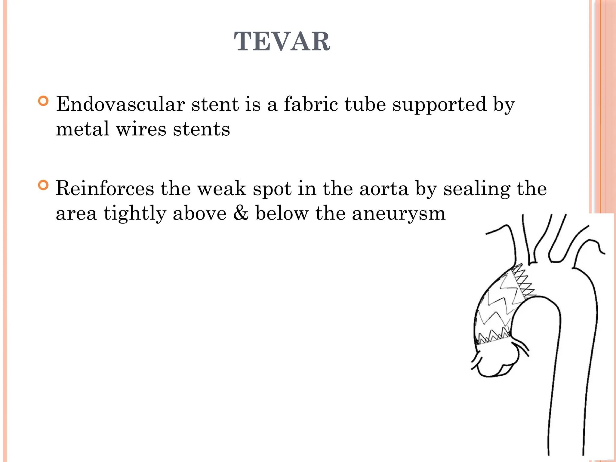 TEVAR
 Endovascular stent is a fabric tube supported by
metal wires stents
 Reinforces the weak spot in the aorta by sealing the
area tightly above & below the aneurysm
 