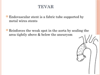 Aortic aneurysm basic, types and management | PPT