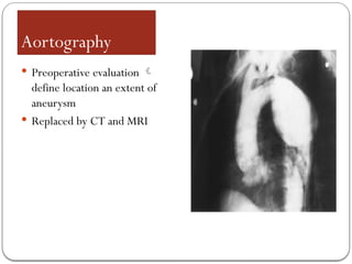 Aortography
 Preoperative evaluation 
define location an extent of
aneurysm
 Replaced by CT and MRI
 