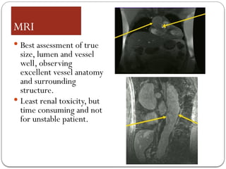 MRI
 Best assessment of true
size, lumen and vessel
well, observing
excellent vessel anatomy
and surrounding
structure.
 Least renal toxicity, but
time consuming and not
for unstable patient.
 
