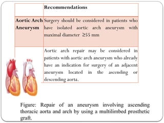 Recommendations
Aortic Arch
Aneurysm
Surgery should be considered in patients who
have isolated aortic arch aneurysm with
maximal diameter ≥55 mm
Aortic arch repair may be considered in
patients with aortic arch aneurysm who already
have an indication for surgery of an adjacent
aneurysm located in the ascending or
descending aorta.
Figure: Repair of an aneurysm involving ascending
thoracic aorta and arch by using a multilimbed prosthetic
graft.
 