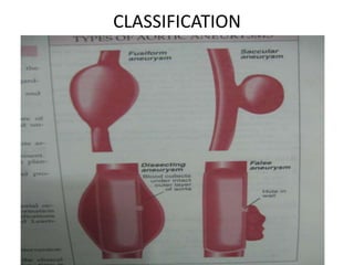CLASSIFICATION
 
