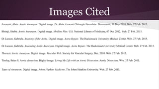 Images Cited
Azencott, Alain. Aortic Aneurysm. Digital image. Dr. Alain Azencott Chirurgie Vasculaire. Dr-azencott, 30 May 2010. Web. 27 Feb. 2015.
Bhimji, Shabir. Aortic Aneurysm. Digital image. Medline Plus. U.S. National Library of Medicine, 07 Oct. 2012. Web. 27 Feb. 2015.
Di Luozzo, Gabriele. Anatomy of the Aorta. Digital image. Aorta Repair. The Hackensack University Medical Center. Web. 27 Feb. 2015.
Di Luozzo, Gabriele. Ascending Aortic Aneurysm. Digital image. Aorta Repair. The Hackensack University Medical Center. Web. 27 Feb. 2015.
Thoracic Aortic Aneurysm. Digital image. Vascular Web. Society for Vascular Surgery, Dec. 2010. Web. 27 Feb. 2015.
Tinsley, Brian S. Aortic dissection. Digital image. Living My Life with an Aortic Dissection. Aortic Dissection. Web. 27 Feb. 2015.
Types of Aneurysm. Digital image. Johns Hopkins Medicine. The Johns Hopkins University. Web. 27 Feb. 2015.
 