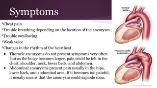 Symptoms
*Chest pain
*Trouble breathing depending on the location of the aneurysm
*Trouble swallowing
*Weak voice
*Changes in the rhythm of the heartbeat
● Thoracic aneurysms do not present symptoms very often
but as the bulge becomes larger, pain could be felt in the
chest, shoulder, neck, lower back, and abdomen.
● Abdominal aneurysms present pain usually in the hips,
lower back, and abdominal area. If it becomes too painful,
it usually means that the aneurysm could explode soon.
 