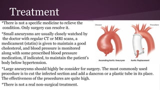Treatment
*There is not a specific medicine to relieve the
condition. Only surgery can resolve it.
*Small aneurysms are usually closely watched by
the doctor with regular CT or MRI scans, a
medicament (statin) is given to maintain a good
cholesterol, and blood pressure is monitored
along with some prescribed blood pressure
medication, if indicated, to maintain the patient’s
body below hypertension.
*Large aneurysms should highly be consider for surgery. The most commonly used
procedure is to cut the infected section and add a dancron or a plastic tube in its place.
The effectiveness of the procedures are quite high.
*There is not a real non-surgical treatment.
 