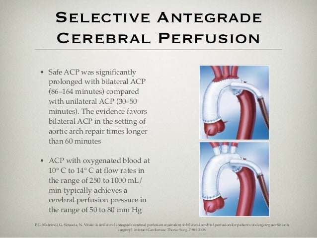aortic aneurysms and dissection