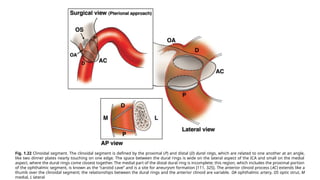 Comprehensive Overview of the Aortic Arch and Cerebral Vessels Anatomy ...
