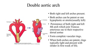 Double aortic arch
• Both right and left arches present.
• Both arches can be patent or one
hypoplastic or atretic(usually left)
• Persistence of both right and left
4th arch which join Truncus
arteriosus sac to their respective
dorsal aortae
• Form complete vascular rings.
• When both arches are patent, rings
typically tight and present with
stridor in first week of life.
 