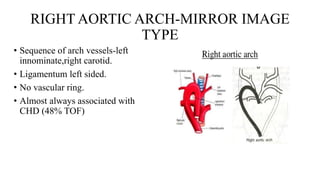 RIGHT AORTIC ARCH-MIRROR IMAGE
TYPE
• Sequence of arch vessels-left
innominate,right carotid.
• Ligamentum left sided.
• No vascular ring.
• Almost always associated with
CHD (48% TOF)
 