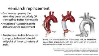 Aortic arch aneurysms in vascular surgery | PPTX