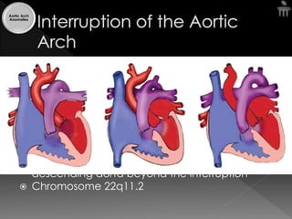 Aortic arch anomalies | PDF