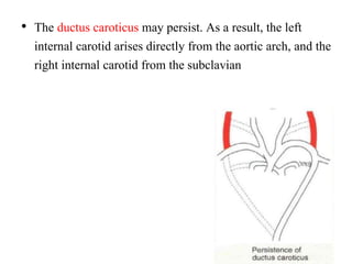 • The ductus caroticus may persist. As a result, the left
internal carotid arises directly from the aortic arch, and the
right internal carotid from the subclavian
 