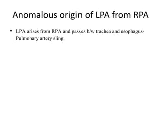 Anomalous origin of LPA from RPA
• LPA arises from RPA and passes b/w trachea and esophagus-
Pulmonary artery sling.
 