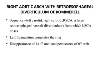 RIGHT AORTIC ARCH WITH RETROESOPHAGEAL
DIVERTICULUM OF KOMMERELL
• Sequence –left carotid, right carotid ,RSCA, a large
retroesophageal vessel( diverticulum) from which LSCA
arises
• Left ligamentum completes the ring
• Disappearance of Lt 4th arch and persistence of 6th arch
 