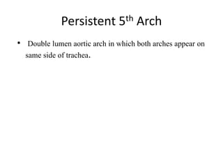Persistent 5th Arch
• Double lumen aortic arch in which both arches appear on
same side of trachea.
 