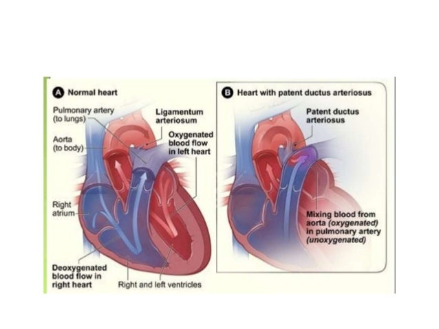 definition of aortic arch