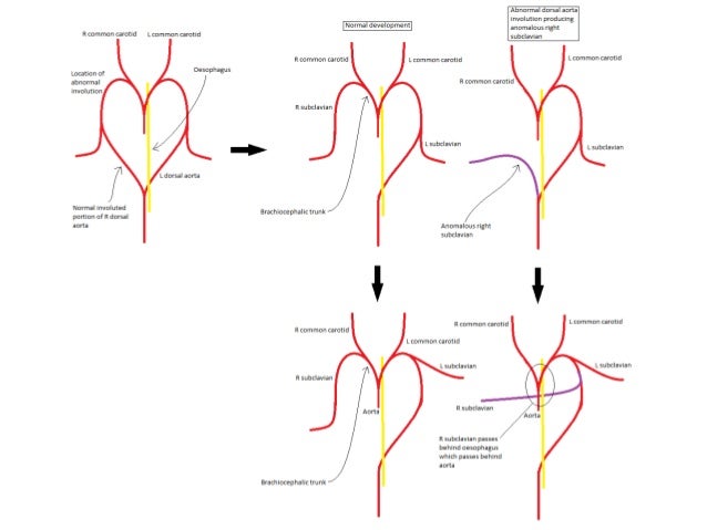 definition of aortic arch definition of aortic arch