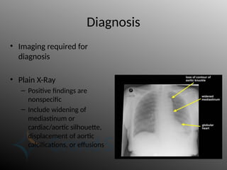 Diagnosis
• Imaging required for
diagnosis
• Plain X-Ray
– Positive findings are
nonspecific
– Include widening of
mediastinum or
cardiac/aortic silhouette,
displacement of aortic
calcifications, or effusions
 