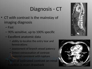 Diagnosis - CT
• CT with contrast is the mainstay of
imaging diagnosis
– Fast
– 90% sensitive, up to 100% specific
– Excellent anatomic data
• ability to localize the entry tear and
fenestrations
• assessment of branch vessel patency
• Detect extravasation of contrast
material consistent with rupture
– Effect of iodinated contrast on renal
function is main drawback
 