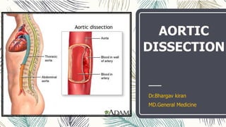 AORTIC
DISSECTION
Dr.Bhargav kiran
MD.General Medicine
 