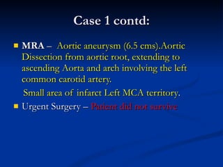 Case 1 contd: MRA  –  Aortic aneurysm (6.5 cms).Aortic Dissection from aortic root, extending to ascending Aorta and arch involving the left common carotid artery. Small area of infarct Left MCA territory . Urgent Surgery –  Patient did not survive 