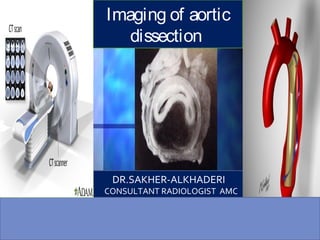 DR.SAKHER-ALKHADERI
CONSULTANT RADIOLOGIST AMC
18/8/2015
Imaging OfImaging of aortic
dissection
 